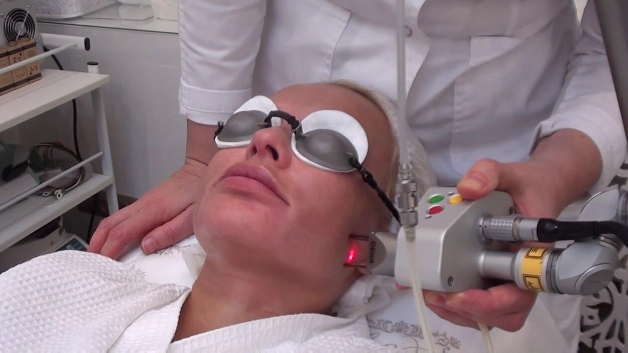 Laser treatment of problem areas on facial skin